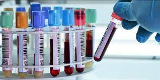 Tem nhãn dán ống nghiệm